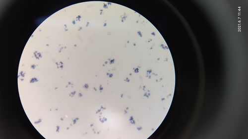 顯微鏡下菌體鑒別技術與食品微生物檢測的應用
